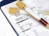 Abnormal MCH effects to HbA1c level