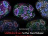 Scientists Kept Mini Brains Alive for 5 Years and They Matured Just Like a Child’s