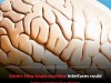 Groundbreaking Brain Interface Allows Paralyzed Patients To Control Robotic Limbs With Thoughts