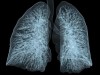 How a $20 Aquarium Inspired a DIY Lung Bioreactor That Regrew a Human Lung