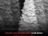 New Microneedle Patch Detects Early Kidney Disease Without The Need For Blood Draws