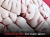 Minimally Invasive Laser Surgery Shows Promise in Extending Life for Brain Cancer Patients