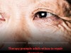 Groundbreaking Gene Therapy Triggers Self Repair In Adult Retinas And Restores Lost Vision